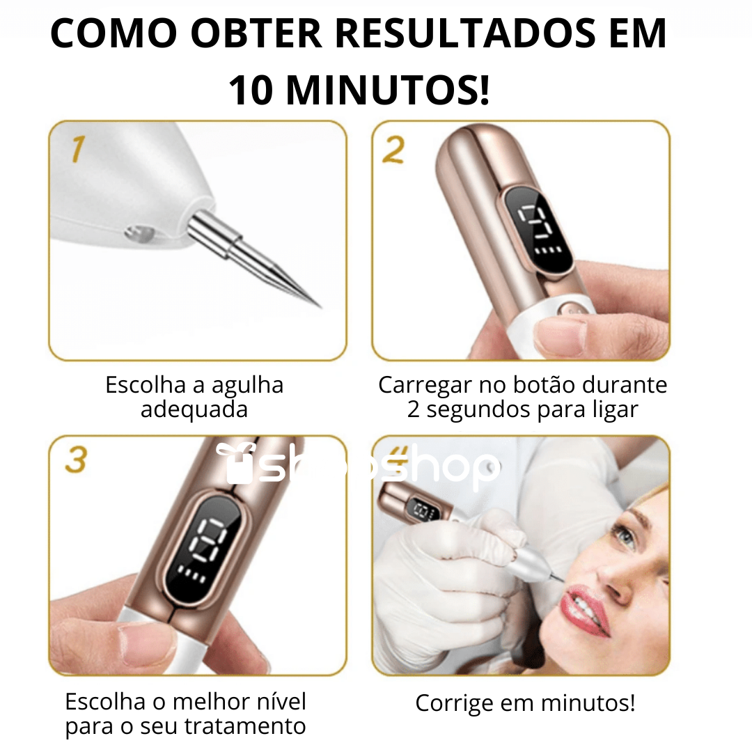 Caneta de Plasma para Remoção de Sinais, Verrugas e Rugas
