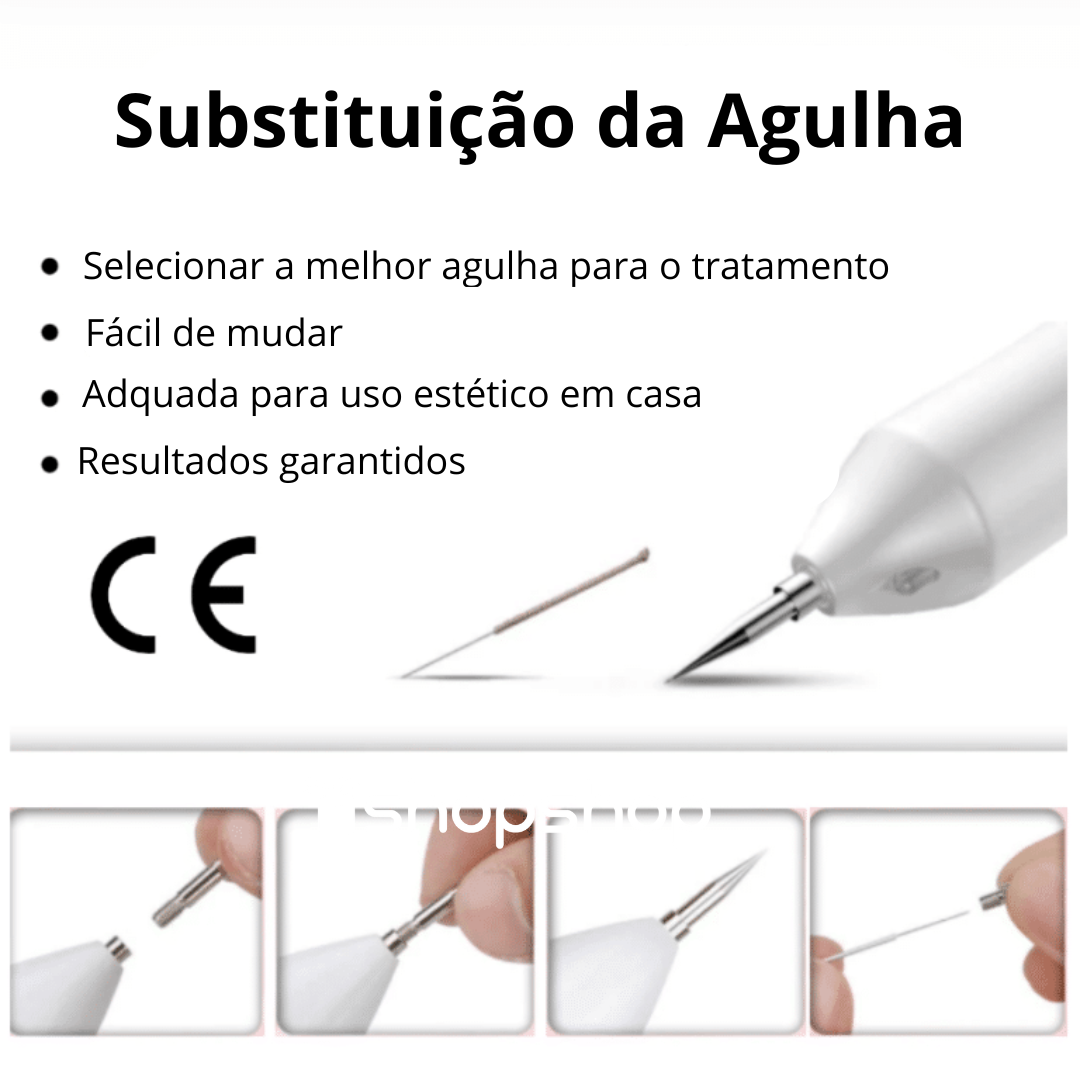 Caneta de Plasma para Remoção de Sinais, Verrugas e Rugas