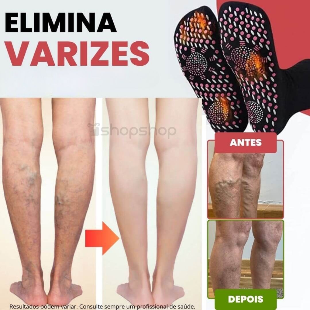 Meias de Acupressão Anti-Varizes Turmalina